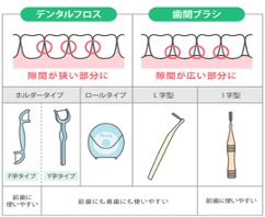 デンタルフロス　歯間ブラシ　説明図