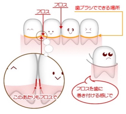 デンタルフロスの重要性と効果って！？