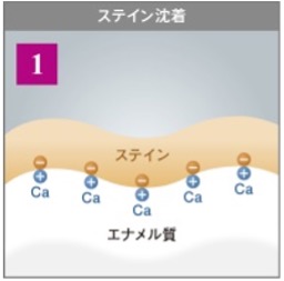 1.ステイン沈着